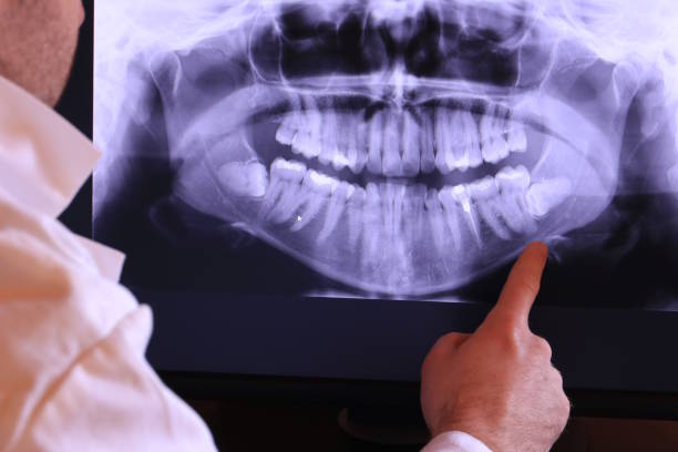 Best Emergency Denture Repair in Millville, NJ